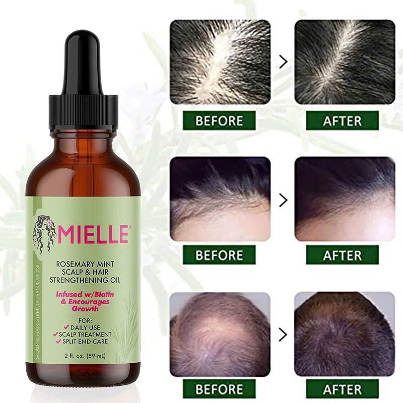MIELLE HAIR GROWTH OIL 60ML